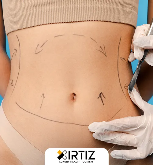 Liposuction Aesthetics Treatment and Cost in Turkey