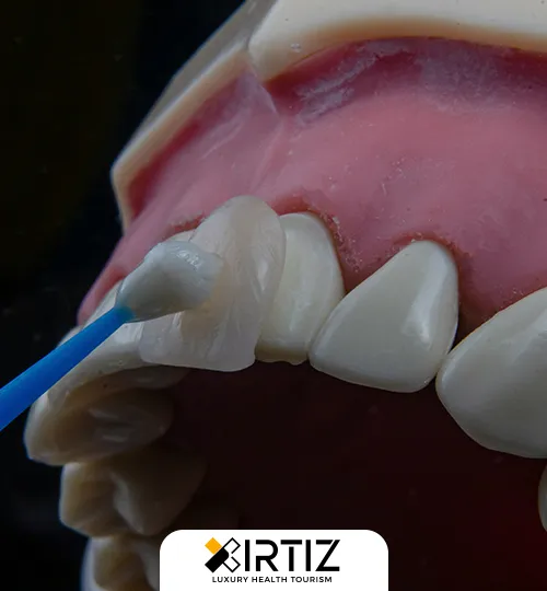 Dental Crowns Treatment and Cost in Turkey