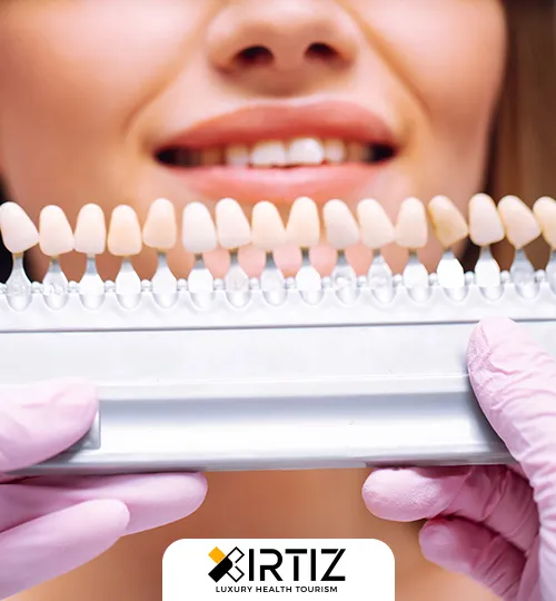 Dental Lumineers Treatment and Cost in Turkey