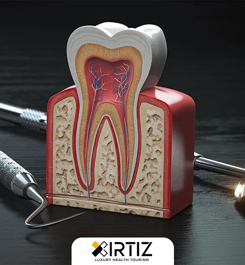 Dental Root Canal Treatment and Cost in Turkey