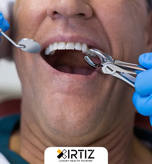 Dental Tooth Extraction Treatment and Cost in Turkey