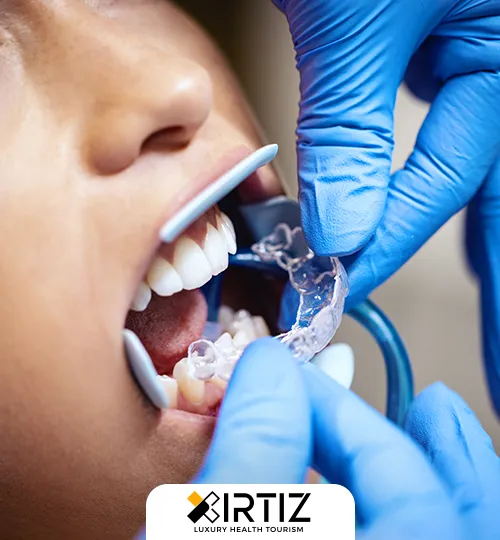 Dental Gum Shield Treatment and Cost in Turkey