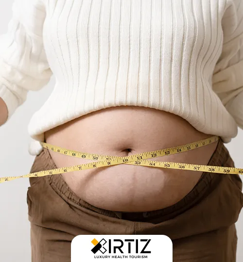 Obesity Gastric Band Treatments and Cost in Turkey